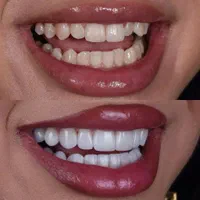 دندانپزشکی/ایمپلنت/لمینت/کامپوزیت زیبایی|خدمات آرایشگری و زیبایی|تهران, مهران (سیدخندان)|دیوار