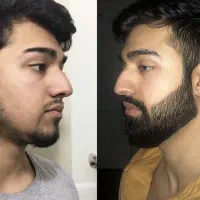 بازی در نیار ریش بزار