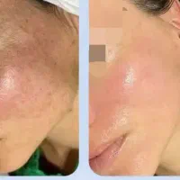فیشیال|خدمات آرایشگری و زیبایی|الیگودرز, |دیوار