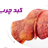 سونای اوزون|آرایشی، بهداشتی، درمانی|مشهد, شهرک امام هادی (شهرک غرب)|دیوار