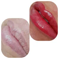 شید لب تضمینی