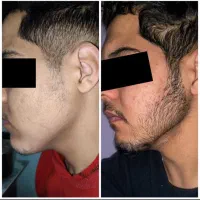 این روش غوغا کرده