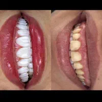 دندانپزشکی|خدمات آرایشگری و زیبایی|تهران, آرژانتین|دیوار