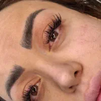 کاشت مژه هیدن فقط ۲۰۰