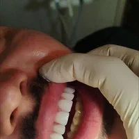 خدمات دندانپزشکی و دندانسازی مستر دِنت|خدمات آرایشگری و زیبایی|ارومیه, |دیوار