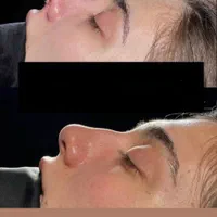 دکتر اسدالله‌پور، جراح برتر بینی در مازندران|خدمات آرایشگری و زیبایی|قائم‌شهر, |دیوار