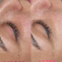 تخفیف آموزش و خدمات فیشیال تخصصی(خانم آقا)|خدمات آرایشگری و زیبایی|دزفول, |دیوار