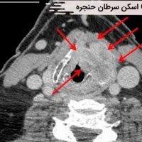 نیازمند وام برای عمل