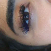 کاشت مژه هیدن بدون چرخش و ریزش