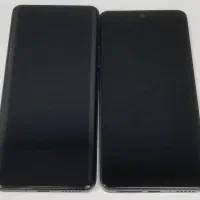 ال سی دی شیاومی روکار