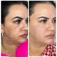 کرم ضد لک‌ روز وشب روژان