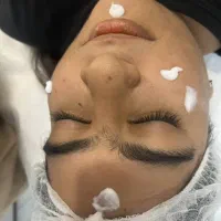 فشیال تخصصی و درمانی|خدمات آرایشگری و زیبایی|مشهد, ایثار|دیوار