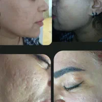 هایفو ،لاغری موضعی،کلیه خدمات پوست،فیشال تخصصی.