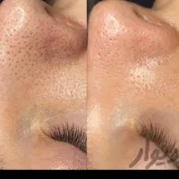 جشنواره فیشیال و پاکسازی و کلیه امور پوست و مو|خدمات آرایشگری و زیبایی|فردیس, فردیس|دیوار