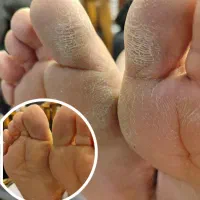 تخفیف ویژه زیبایی