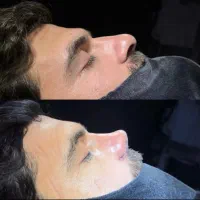همکاری با پزشک و دستیار ent
