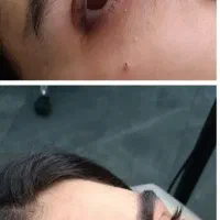 میکرو  ابرو