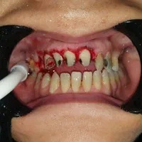 خدمات دندانپزشکی برلیان|خدمات آرایشگری و زیبایی|بانه, |دیوار