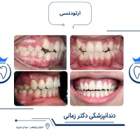 ارتودنسی ثابت و نامرئی (دیجیتال) با شرایط اقساط|خدمات زیبایی و سلامت|تهران, امیریه|دیوار