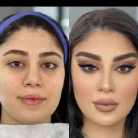 تخفیف ویژه