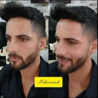 تزریق ژل و بوتاکس به صورت تخصصی