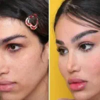 تزریق بوتاکس و لیفت چشم گربه ای  جدیدترین متد|خدمات آرایشگری و زیبایی|ری, دیلمان|دیوار