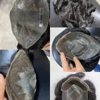 پروتز مو