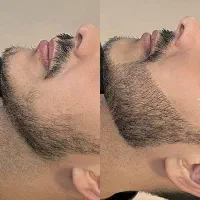 ریش روشن با کمترین هزینه