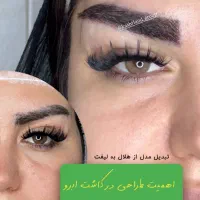 جشنواره اقساطی کاشت ابرو موبلفاروپلاستی غبغب تهران