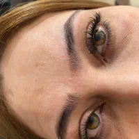 موخوره گیری 200 فر مودائمی کوتاهی کاشت مژه