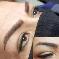 نیازمند مدل فیبروز ابروبرای فردا هزینه ۵۰۰