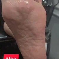 پدیکور تخفیف یلدا