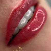 ۵۰٪تخفیف ویژه کلینیک نورا|خدمات آرایشگری و زیبایی|محمدشهر, محمدشهر|دیوار