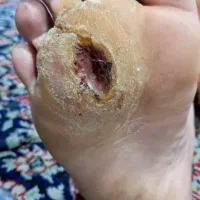 زیبایی درمانی|خدمات آرایشگری و زیبایی|بوشهر, |دیوار