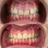 ارتودنسی با شرایط اقساط و منعطف|خدمات آرایشگری و زیبایی|تهران, دزاشیب|دیوار