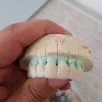 ساخت انواع دست دندان .روکش .لمینت باکیفیت بالا|آرایشی، بهداشتی، درمانی|تهران, مجیدیه|دیوار