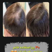 روتین روغن مو عراقی ارگان رزماری بنت السلطان سرشور|آرایشی، بهداشتی، درمانی|مشهد, خواجه ربیع|دیوار