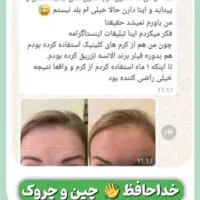 نمایندگی رسمی گاتیو کرم بوتاکس پنج کاره|آرایشی، بهداشتی، درمانی|قم, یزدان‌شهر|دیوار