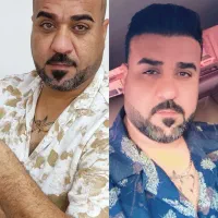 کاشت و ترمیم مو با SUT و میکروگرفت