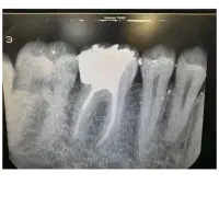 اطلاعیه پذیرش بیمار کانپوزیت دندانپزشکی