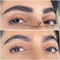 فیبروز ابرو، ریموو تک جلسه ای تتو قدیمی ابرو