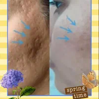 خاویارتراپی صورت و بدن|خدمات آرایشگری و زیبایی|مشهد, طلاب|دیوار