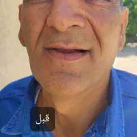 ساخت دندان مصنوعی کامل و تکه ای ضمانتی|آرایشی، بهداشتی، درمانی|مرودشت, بیست متری بیمارستان|دیوار