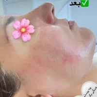 فشیال و اسکراب اسکالپ بطور تخصصی|خدمات آرایشگری و زیبایی|سبزوار, کاشفی شمالی (دادگستری)|دیوار