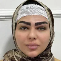 جشنواره کاشت ابرو تراکم بالا،مدل کاشت،مژه دائم