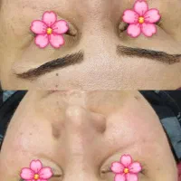 فیشیال تخصصی توسط پیراپزشک با۳۰٪تخفیف درکلینیک|خدمات آرایشگری و زیبایی|شیراز, خلدبرین|دیوار