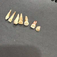 دندان شیری و دائمی برای دانشجویان|پزشکی|بیرجند, |دیوار