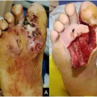 کارشناس دیابت|خدمات آرایشگری و زیبایی|امامزاده عبدالله, |دیوار