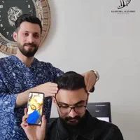 کاشت شیرازی موی سر و ابرو در ارومیه به مدت کوتاه