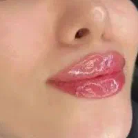 باکمترین هزینه خودت زیباکن فقط وفقط بایک ملیون